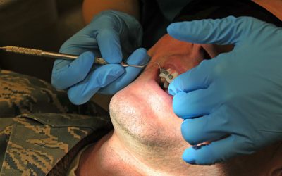 Benefits Of Using SS 316L In Orthodontics Treatment