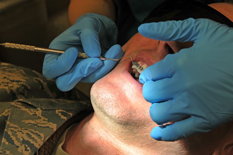 SS 316L in orthodontics treatment