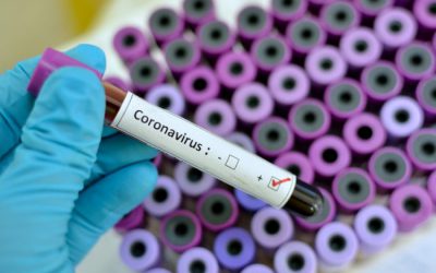 How has the COVID-19 affected the Steel Industry?